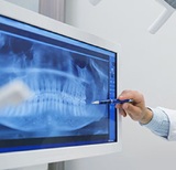 Dental Scaling and Root Planing Explained