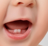 White or Brown Spots on Baby Teeth