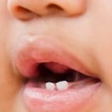 Baby Teeth: When Do They Come in & Fall Out? Baby Teeth: When Do They Come in & Fall Out?
