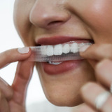 Affordable and Cheap Teeth Whitening Options Affordable and Cheap Teeth Whitening Options