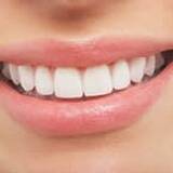 How Much Does Whitening Cost? How Much Does Whitening Cost?